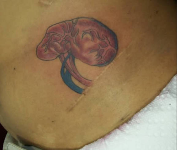 scary tattoos, kidney