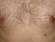 Almost ten percent of people have are born with a third nipple.