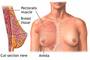 Female breasts start developing under the influence of the hormones produced in the ovaries.