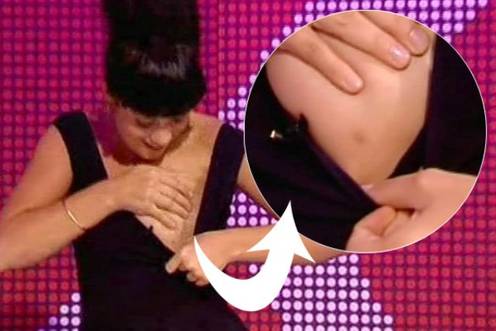 Lily Allen showed her third nipple.
