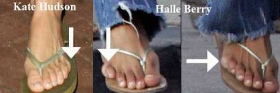 celebrity body defects 9