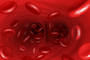 HIV protection is better in circumcised men. (Photoxpress)