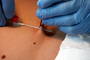 Navel piercing