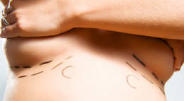 Breast enlargement