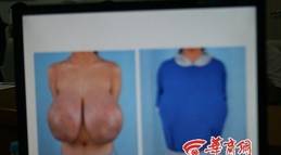 huge breasts