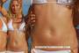celebrity body defects 1