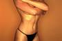 In the UK, there’s a growing tendency among young women to undergo vaginoplasty. (jlp)