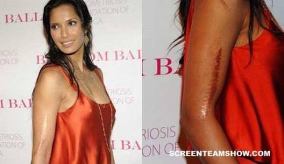 celebrity body defects 4