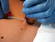 Navel piercing