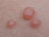 Don't allow yourself to scratch these itchy little "pimples"!