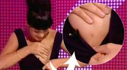 third nipple